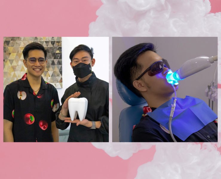 Laser Teeth Whitening VariaHealth