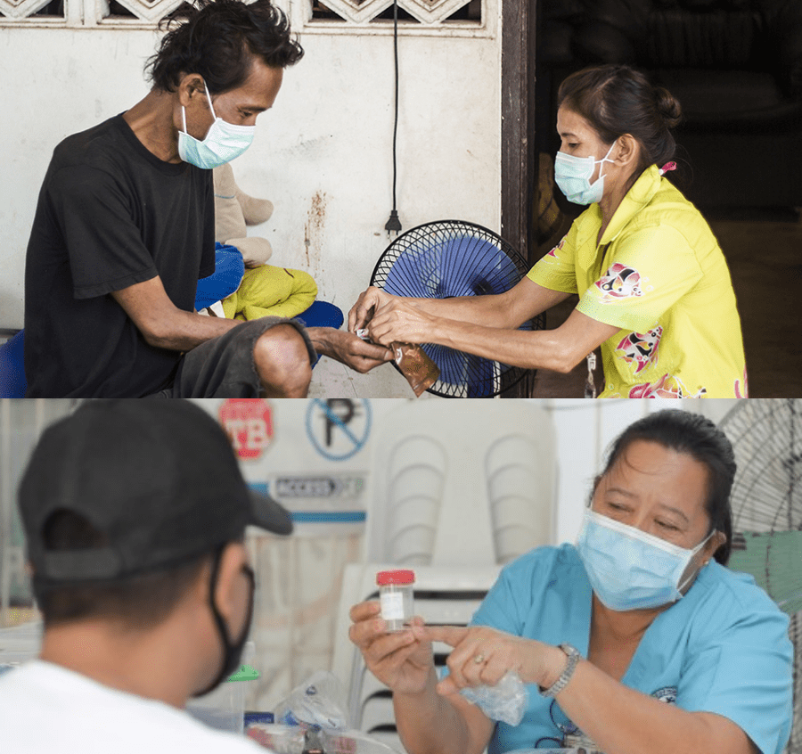 Tuberculosis